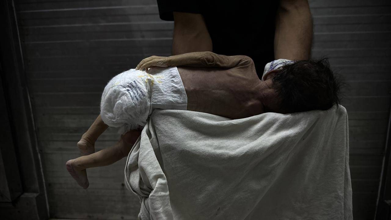 Gazze'de savaşın gölgesinde bebek ölümleri ve doğum kusurları artıyor