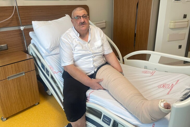 İstanbul'da fil hastasının 2 katına çıkan bacağındaki şişlik tedaviyle geriledi